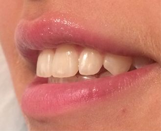 Clínica Dental​ labios y dientes