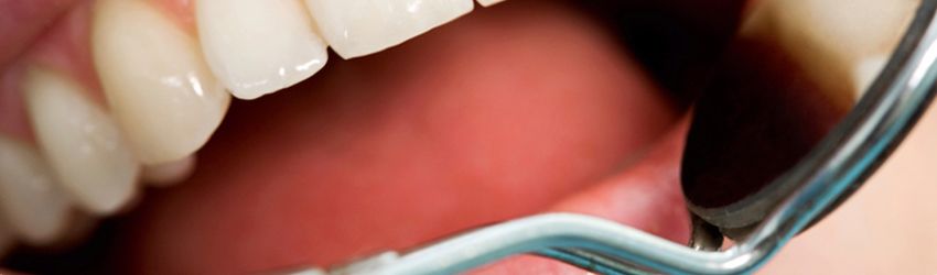 Clínica Dental​ revisión odontológica